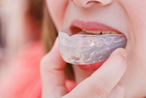 AQD_mouthguard